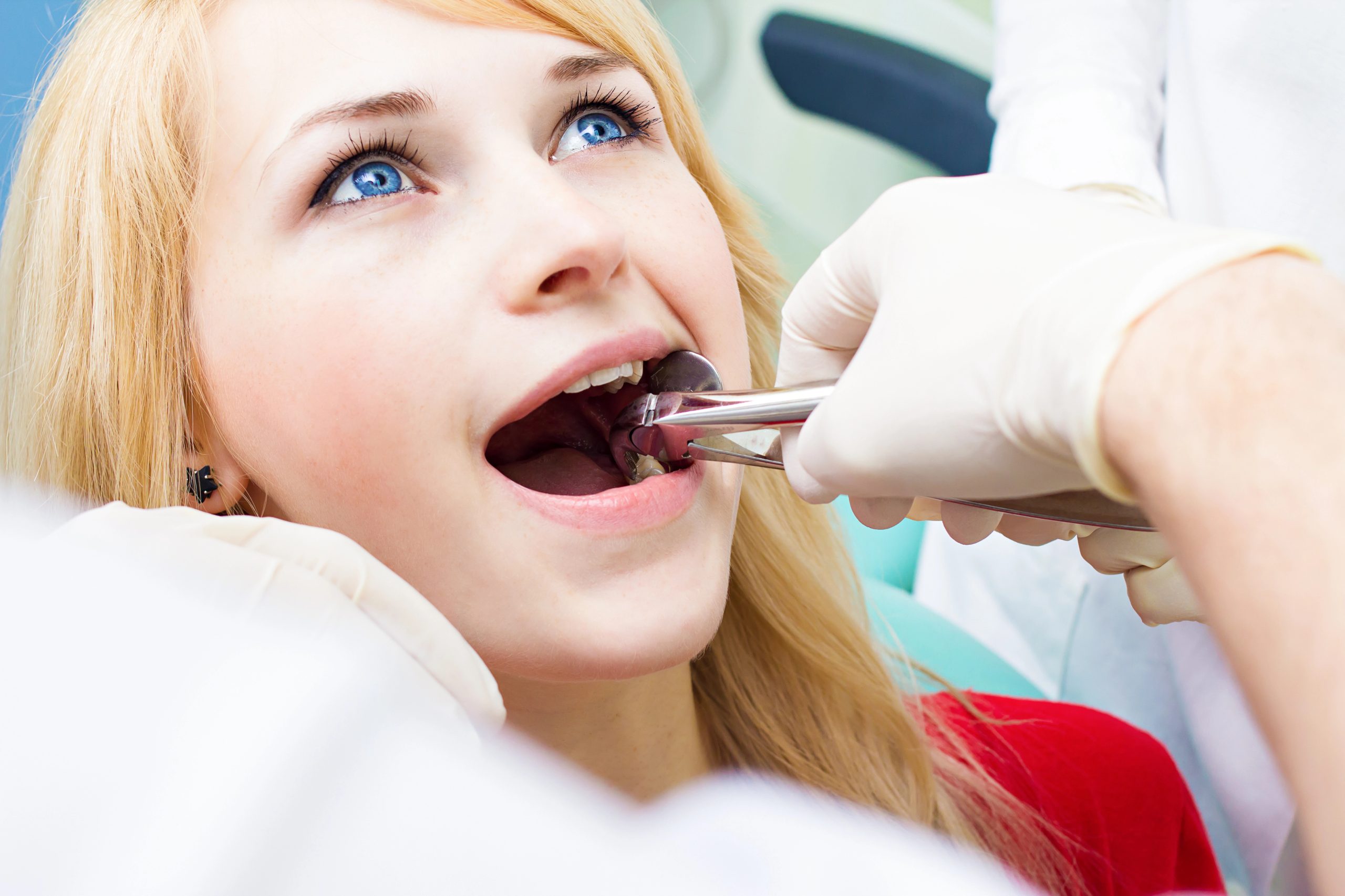 Tooth Extraction Benefits Why It’s Necessary